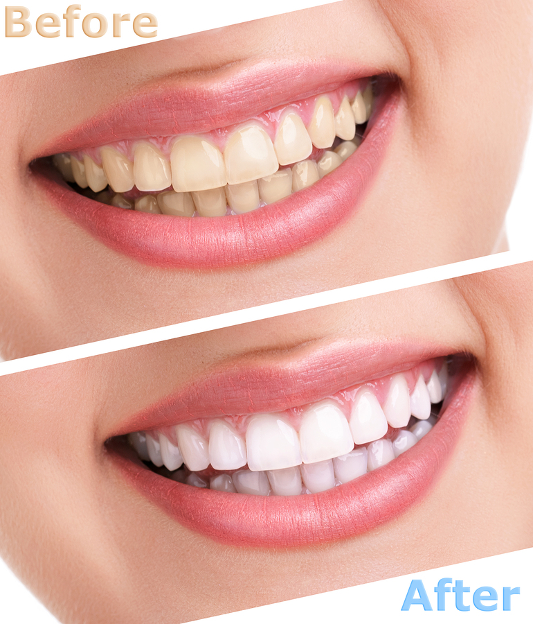 Get The Right Dental Treatment for Your Normal Oral Health